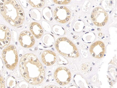 DAB staining on fromalin fixed paraffin-embedded Kidney tissue)