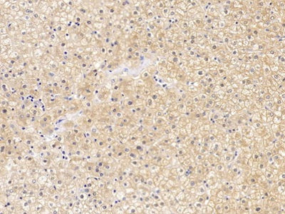 Claudin 1 (CLDN1) Polyclonal Antibody - image 4
