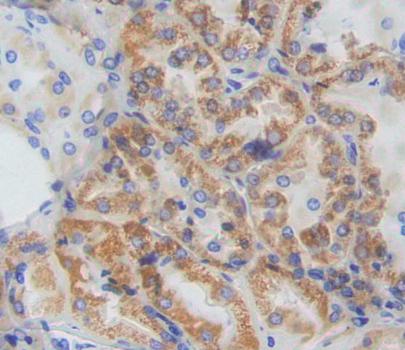 Cytokine Inducible SH2 Containing Protein (CISH) Polyclonal Antibody - image 3