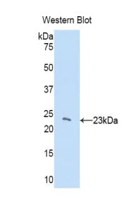 Chromobox Homolog 3 (CBX3) Polyclonal Antibody - image 2