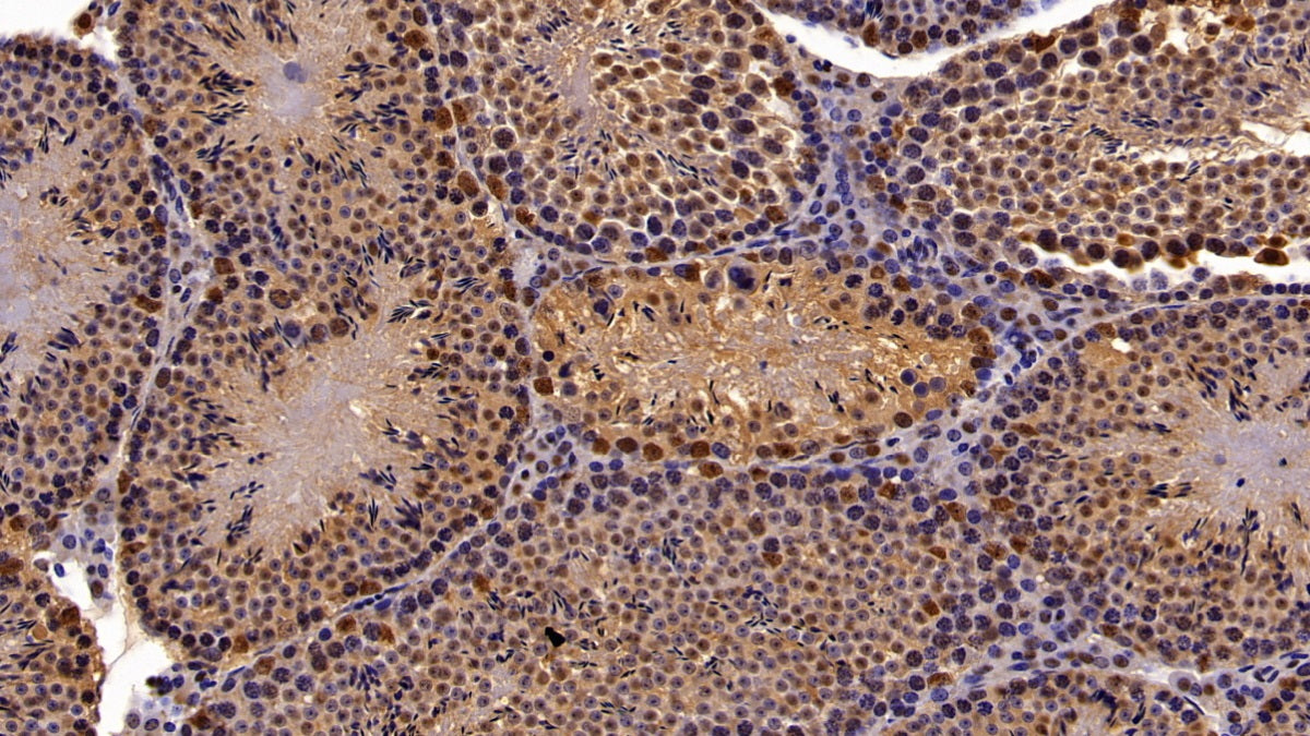 Chromobox Homolog 3 (CBX3) Polyclonal Antibody - image 3