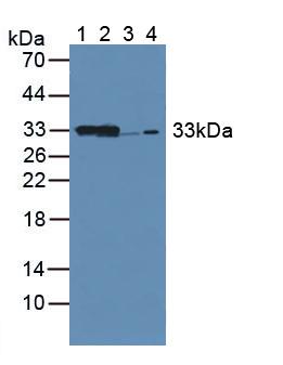 Western Blot; Sample: Recombinant CBR1, Mouse.