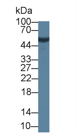 Western Blot; Sample: Human Lung lysate; <br/>Primary Ab: 1µg/ml Rabbit Anti-Human CANT1 Antibody<br/>Second Ab: 0.2µg/mL HRP-Linked Caprine Anti-Rabbit IgG Polyclonal Antibody<br/>