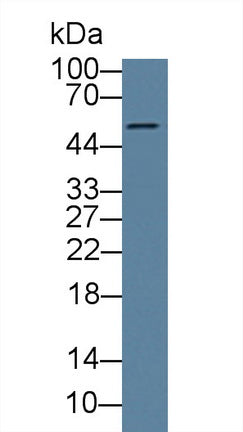 DAB staining on IHC-P; Samples: Human Liver Tissue; Primary Ab: 20µg/ml Rabbit Anti-Human CANT1 Antibody Second Ab: 2µg/mL HRP-Linked Caprine Anti-Rabbit IgG Polyclonal Antibody