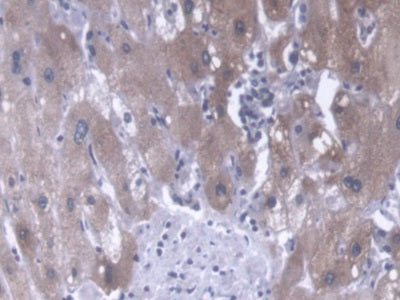 DAB staining on fromalin fixed paraffin- embedded brain tissue)