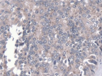 Calcium Activated Nucleotidase 1 (CANT1) Polyclonal Antibody - image 5