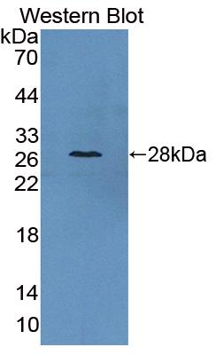 Western Blot; Sample: Lane1: Mouse Cerebrum lysate; Lane2: Mouse Testis lysate; Lane3: Mouse Small intestine lysate; ; Primary Ab: 1µg/ml Rabbit Anti-Mouse CAMLG Antibody; Second Ab: 0.2µg/mL HRP-Linked Caprine Anti-Rabbit IgG Polyclonal Antibody;