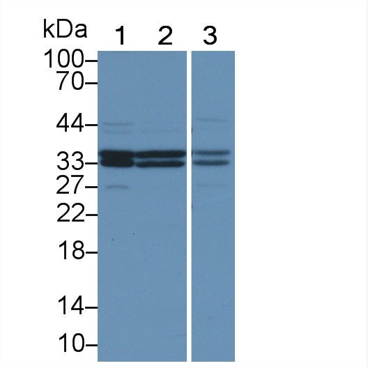 DAB staining on IHC-P; Samples: Mouse Cerebrum Tissue; Primary Ab: 20μg/ml Rabbit Anti-Mouse CAMLG Antibody Second Ab: 2µg/mL HRP-Linked Caprine Anti-Rabbit IgG Polyclonal Antibody
