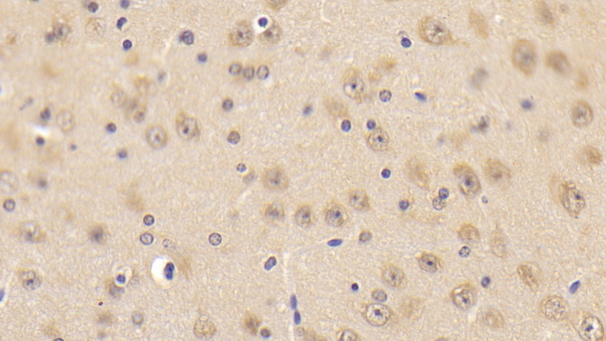 DAB staining on fromalin fixed paraffin- embedded Kidney tissue)