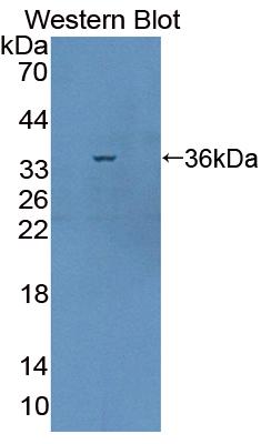 Calcineurin Binding Protein 1 (CABIN1) Polyclonal Antibody - image 2