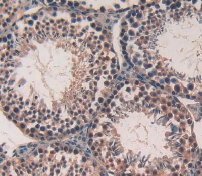 Calcineurin Binding Protein 1 (CABIN1) Polyclonal Antibody - image 3