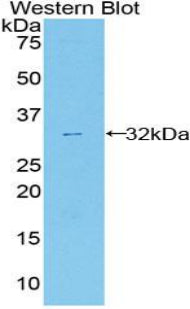 Used in DAB staining on fromalin fixed paraffin-embedded Liver tissue