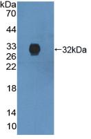 DAB staining on IHC-P; Samples: Human Prostate Tissue; Primary Ab: 10µg/ml Rabbit Anti-Human ANXA6 Antibody Second Ab: 2µg/mL HRP-Linked Caprine Anti-Rabbit IgG Polyclonal Antibody