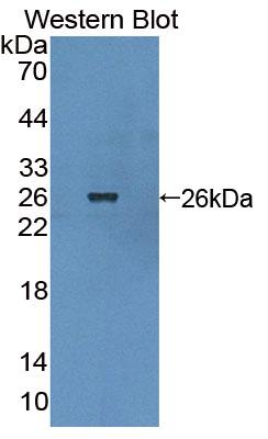 Breakpoint Cluster Region (BCR) Polyclonal Antibody - image 2