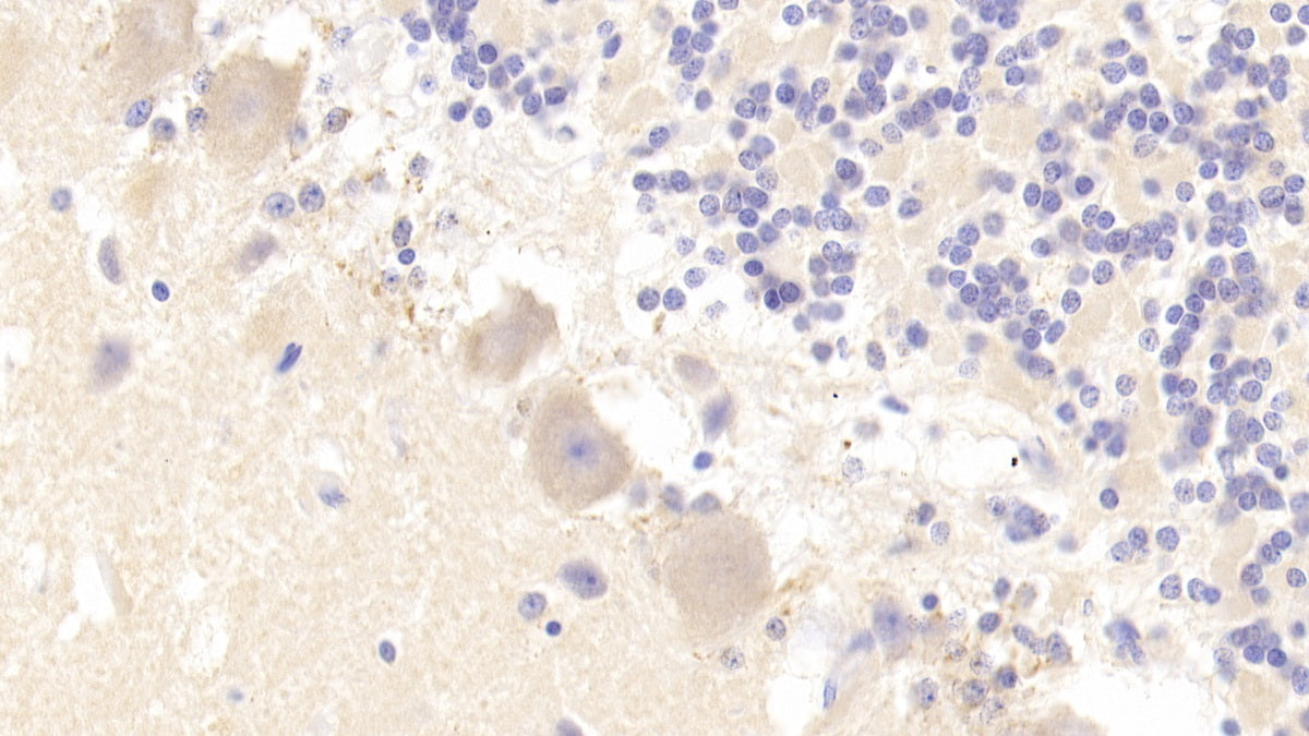 DAB staining on fromalin fixed paraffin- embedded Kidney tissue)