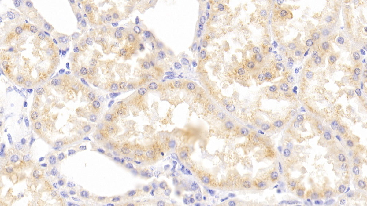 Breakpoint Cluster Region (BCR) Polyclonal Antibody - image 4