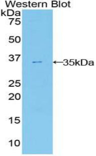 Ectonucleotide Pyrophosphatase/Phosphodiesterase 2 (ENPP2) Polyclonal Antibody - image 2