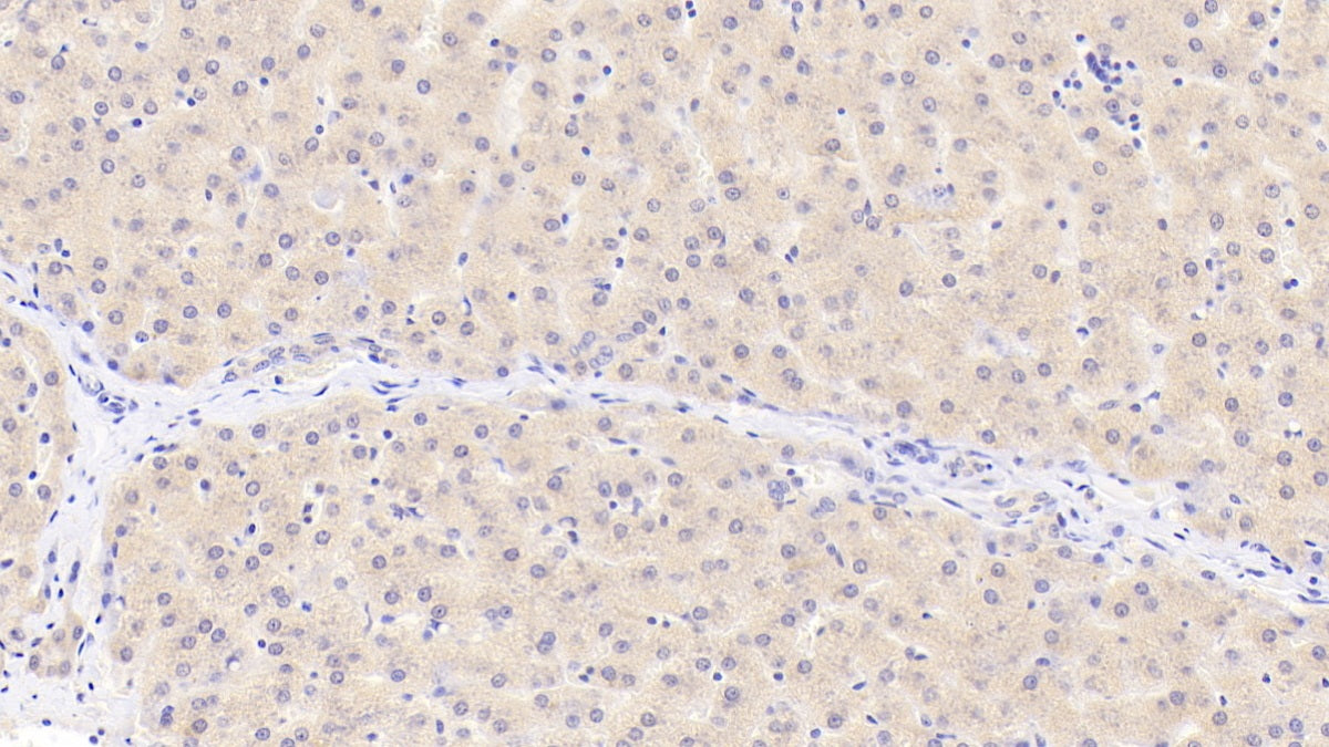 DAB staining on fromalin fixed paraffin-embedded ovary tissue)