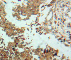 Ectonucleotide Pyrophosphatase/Phosphodiesterase 2 (ENPP2) Polyclonal Antibody - image 4