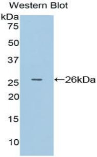 Adenomatosis Polyposis Coli Protein (APC) Polyclonal Antibody - image 2