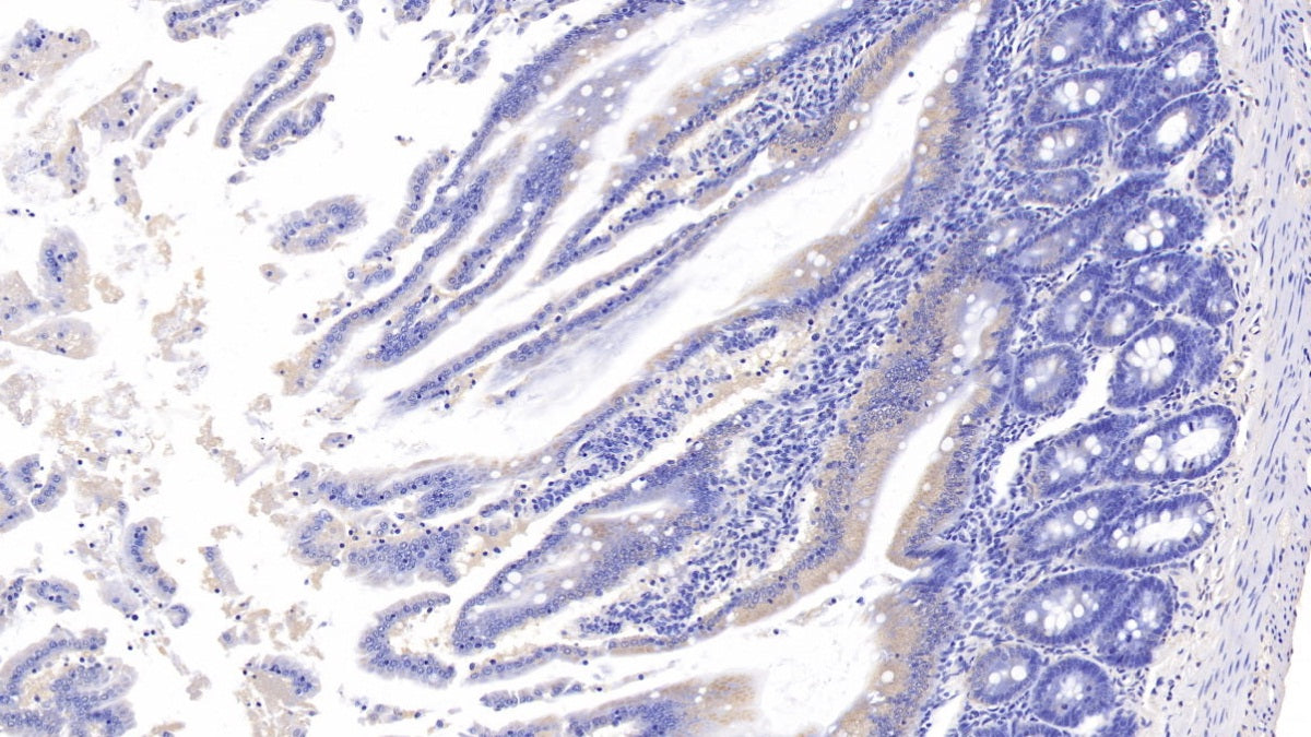 Adenomatosis Polyposis Coli Protein (APC) Polyclonal Antibody - image 4