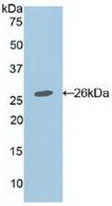Adenomatosis Polyposis Coli Protein (APC) Polyclonal Antibody - image 2