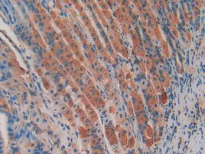 Adenomatosis Polyposis Coli Protein (APC) Polyclonal Antibody - image 4