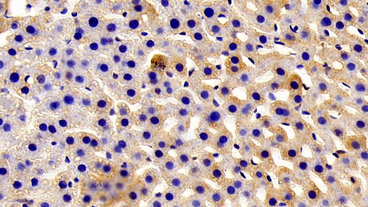 Antizyme Inhibitor 1 (AZIN1) Polyclonal Antibody - image 3