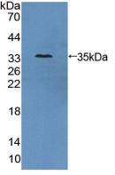 DAB staining on IHC-P; Samples: Human Liver Tissue; Primary Ab: 10µg/ml Rabbit Anti-Human AZIN1 Antibody Second Ab: 2µg/mL HRP-Linked Caprine Anti-Rabbit IgG Polyclonal Antibody