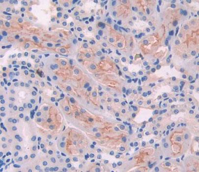 Ancient Ubiquitous Protein 1 (AUP1) Polyclonal Antibody - image 3