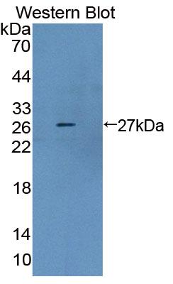 DAB staining on IHC-P; Samples: Human Stomach Tissue;  Primary Ab: 10µg/ml Rabbit Anti-Human AUP1 An
