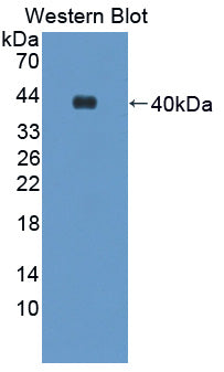 Aminolevulinate Delta Dehydratase (ALAD) Polyclonal Antibody - image 2