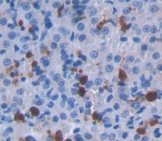 Aminolevulinate Delta Dehydratase (ALAD) Polyclonal Antibody - image 3