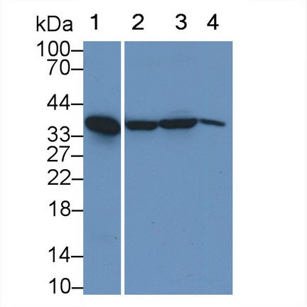 DAB staining on IHC-P; Samples: Human Stomach Tissue; Primary Ab: 30µg/ml Rabbit Anti-Human ALAD Antibody Second Ab: 2µg/mL HRP-Linked Caprine Anti-Rabbit IgG Polyclonal Antibody