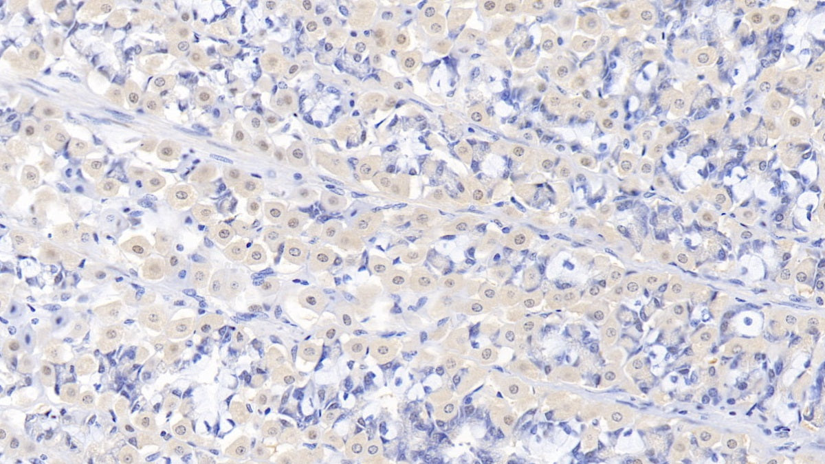 DABstainingonIHC-P.Samples:HumanTissue)