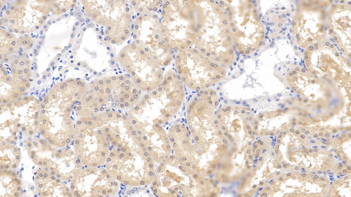 Aminolevulinate Delta Dehydratase (ALAD) Polyclonal Antibody - image 5