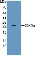 DAB staining on IHC-P; Samples: Rat Liver Tissue; Primary Ab: 20µg/ml Rabbit Anti-Rat AK2 Antibody Second Ab: 2µg/mL HRP-Linked Caprine Anti-Rabbit IgG Polyclonal Antibody