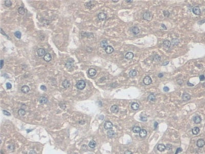 DAB staining on IHC-P; Samples: Rat Large Intestine Tissue