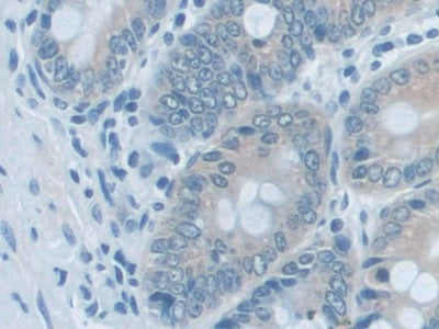 Adenylate Kinase 2 (AK2) Polyclonal Antibody - image 5