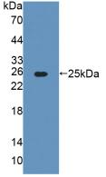 DAB staining on IHC-P; Samples: Rat Liver Tissue;  Primary Ab: 20µg/ml Rabbit Anti-Rat AGXT Antibody