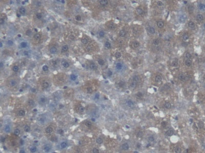 Alanine Glyoxylate Aminotransferase (AGXT) Polyclonal Antibody - image 5