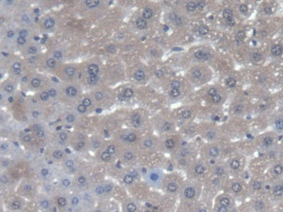 DAB staining on fromalin fixed paraffin- embedded liver tissue)