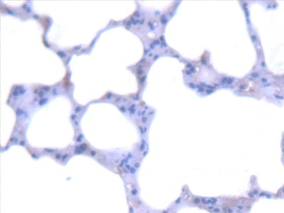 Alanine Glyoxylate Aminotransferase (AGXT) Polyclonal Antibody - image 4