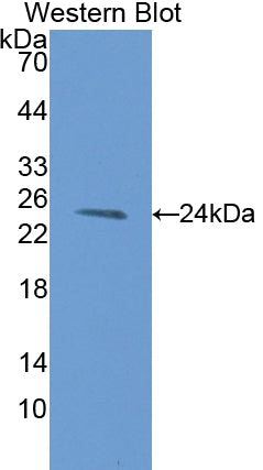 Anterior Gradient 2 (AGR2) Polyclonal Antibody - image 2