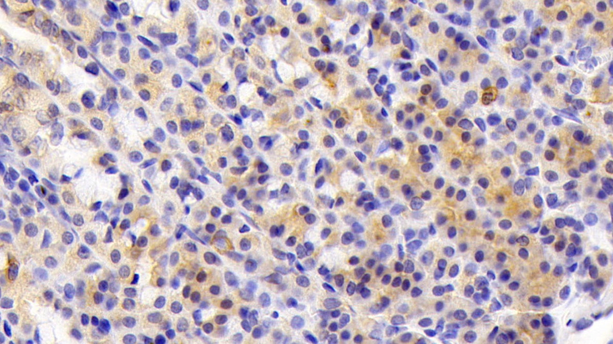 DAB staining on fromalin fixed paraffin-embedded kidney tissue)