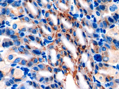 Anterior Gradient 2 (AGR2) Polyclonal Antibody - image 5