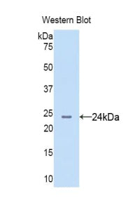 DAB staining on IHC-P; Samples: Human Stomach Tissue;  Primary Ab: 20µg/ml Rabbit Anti-Human AGR2 Antibody Second Ab: 2µg/mL HRP-Linked Caprine Anti-Rabbit IgG Polyclonal Antibody