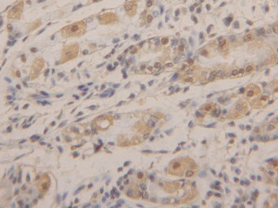 DAB staining on IHC-P; Samples: Human Stomach Tissue)