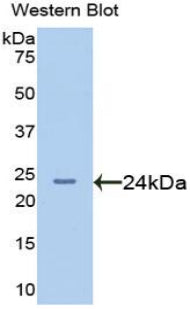 Afamin (AFM) Polyclonal Antibody - image 2