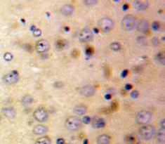 Afamin (AFM) Polyclonal Antibody - image 3